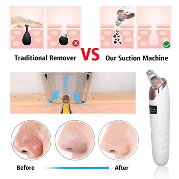 Face Vacuum Suction Blackhead Remover Pore Cleaner |  Nose & Face