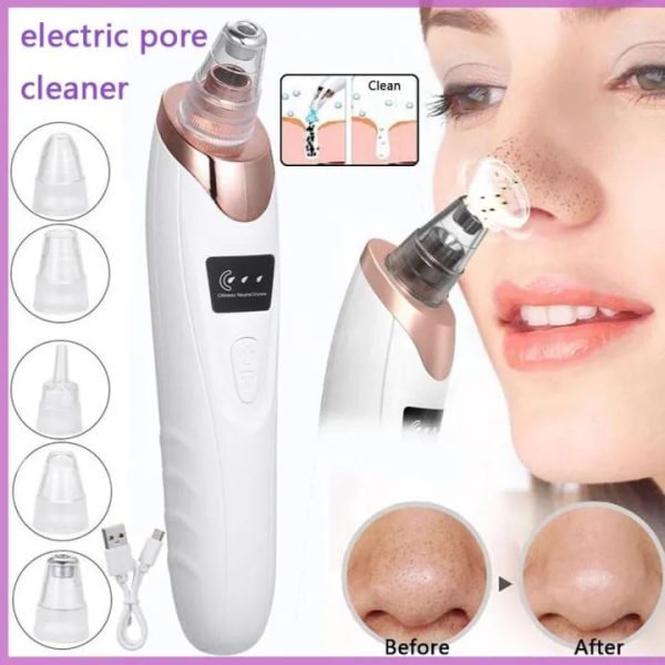 Face Vacuum Suction Blackhead Remover Pore Cleaner |  Nose & Face